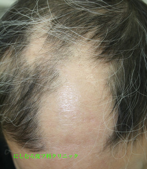 Img_4399_2 Img_4399_2