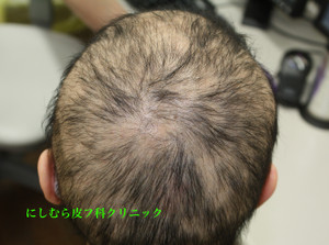 Img_5972_2 Img_5972_2