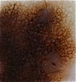 3ccdfdbec7064ab4957f641ff6e914c7_2 3ccdfdbec7064ab4957f641ff6e914c7_2