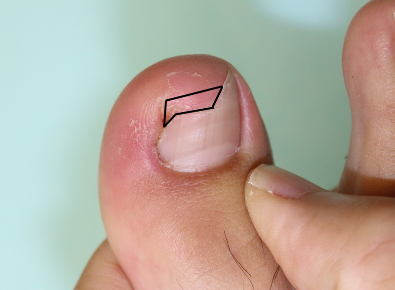 Img_5512_2 Img_5512_2