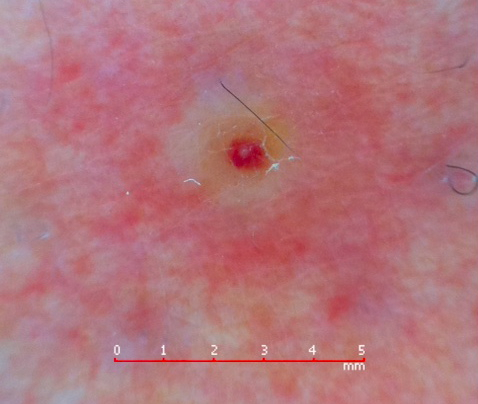 6ed6f584588c45b79aa4c9b677e96389 6ed6f584588c45b79aa4c9b677e96389