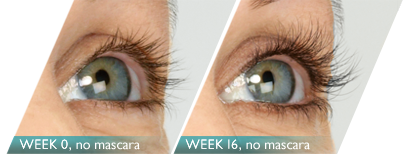 Latisse_00_shannon_eyes