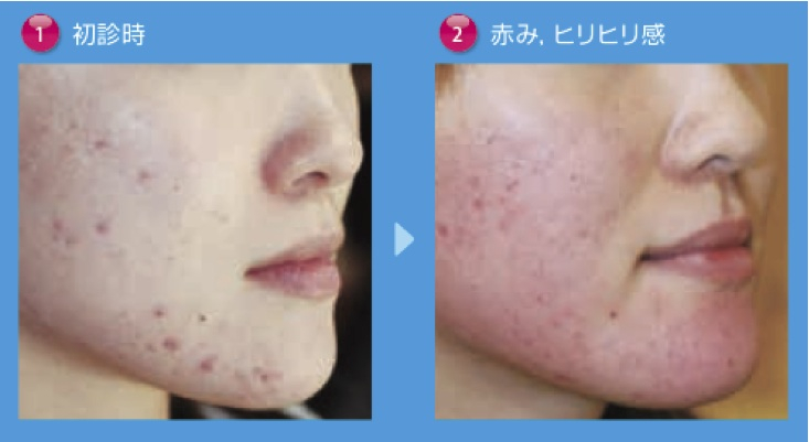 Snapz_pro_xscreensnapz018 Snapz_pro_xscreensnapz018