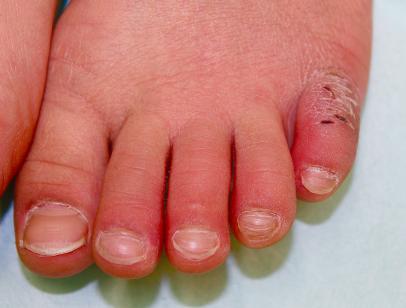 Img_9405_1 Img_9405_1