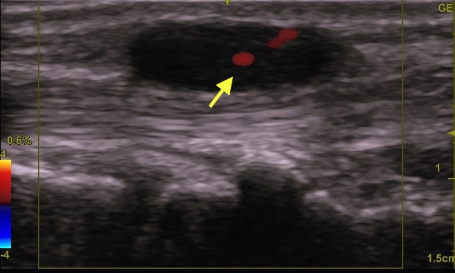 1512063168 1512063168