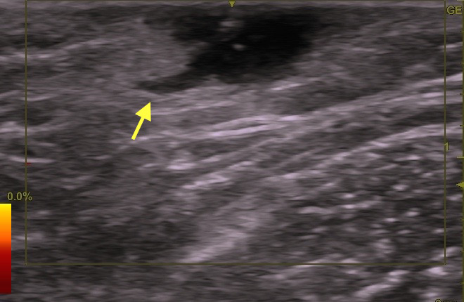 1514453559 1514453559