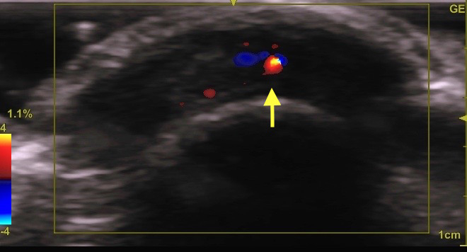 1518867271 1518867271