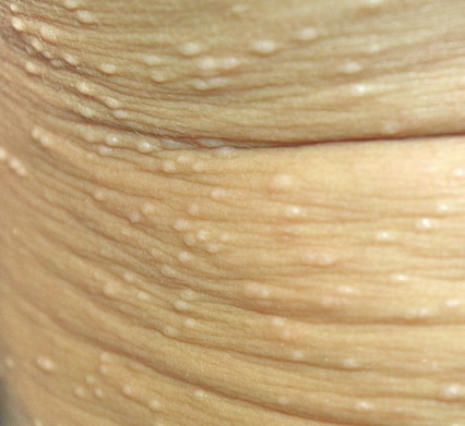 34cdaf8ae1224ad6b603c4b791490a99_1 34cdaf8ae1224ad6b603c4b791490a99_1