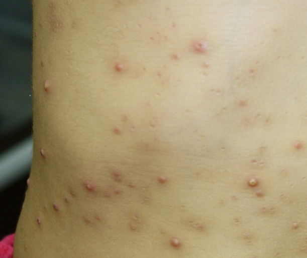 898bbb055ac640cba6bec44032193256_1 898bbb055ac640cba6bec44032193256_1