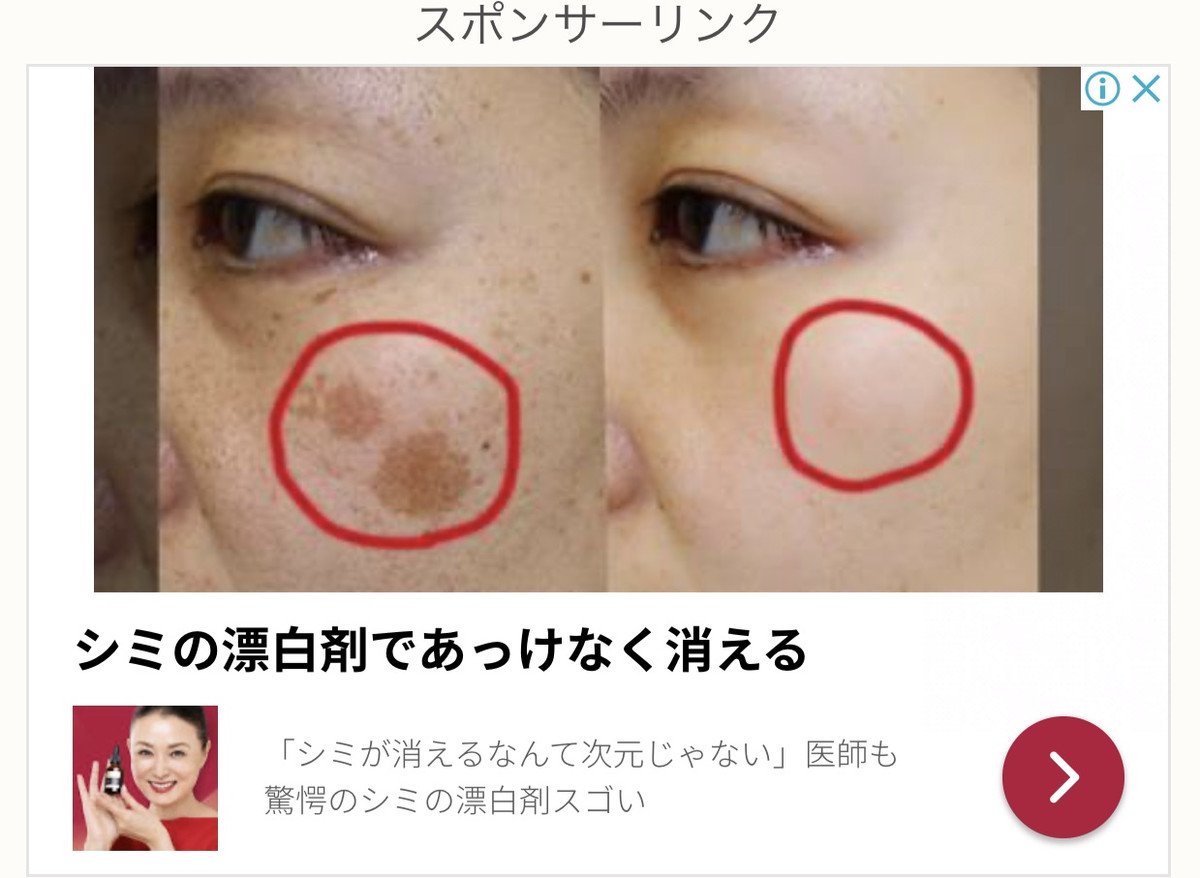 746b45534a004200b1808744f01b9024_2