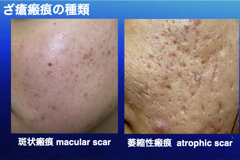 3smart001_3 3smart001_3