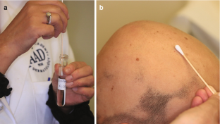 440271_1_en_3_fig3_html 440271_1_en_3_fig3_html